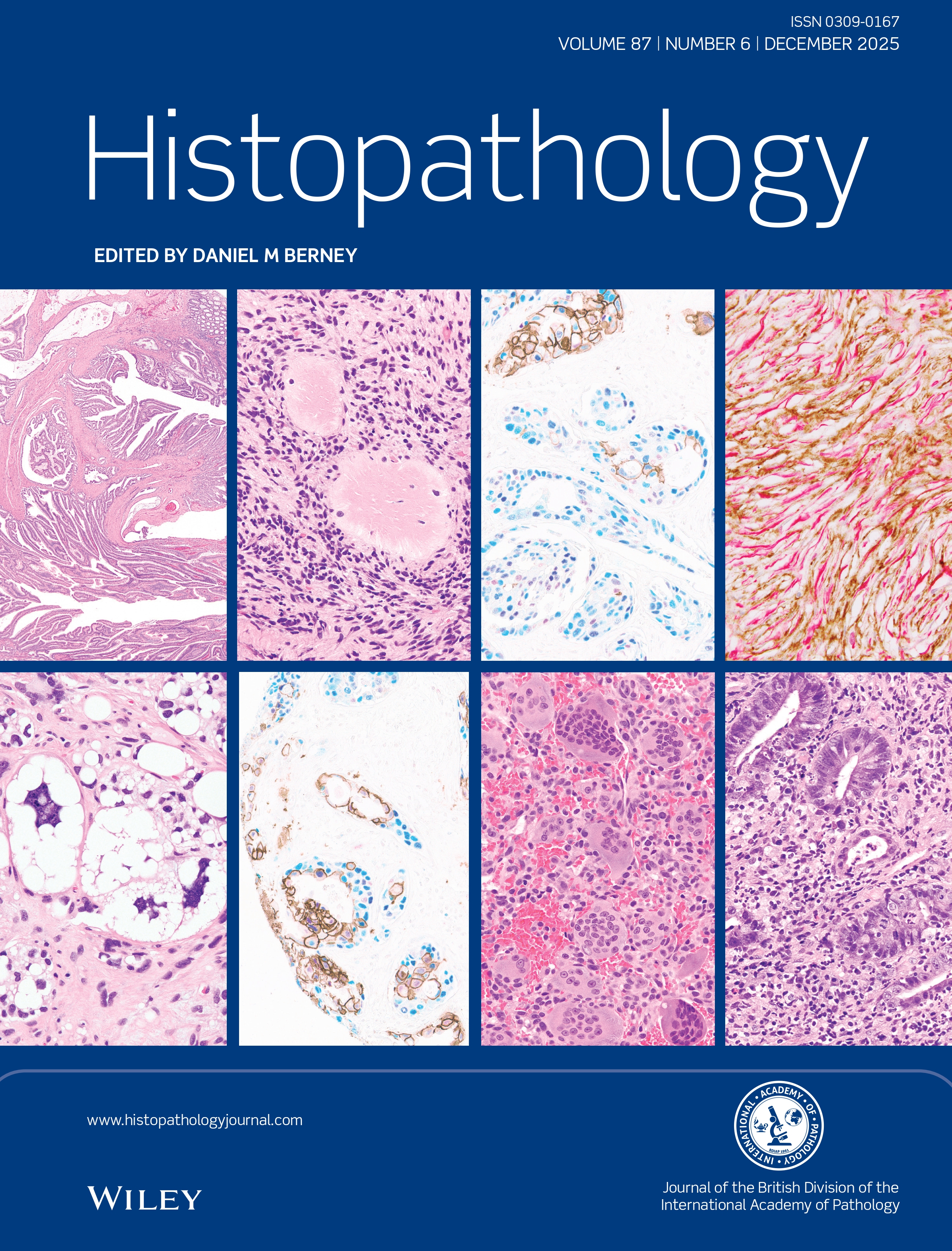 Histopathology: Vol 87, No 6